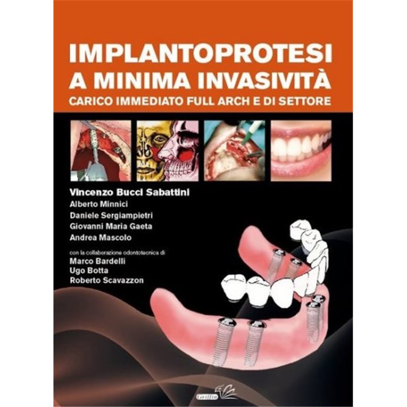 Implantoprotesi a minima invasività - Carico immediato Full Arch e di settore